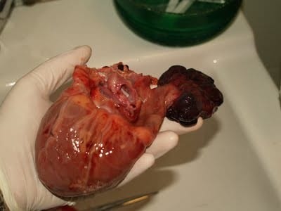 emangiosarcoma_cardiaco